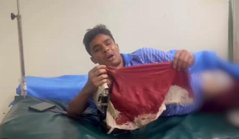 রাজপথে রক্তাক্ত শিক্ষার্থী: কাজী পরিবহনের বর্বর হামলায় উত্তাল IUBAT